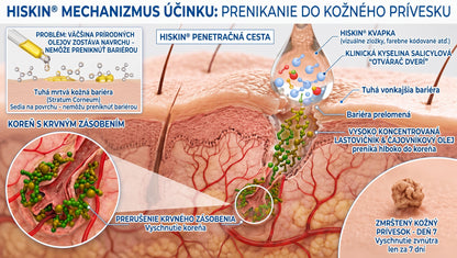 𝐇𝐢𝐬𝐤𝐢𝐧® 2-v-1 pokročilý bezbolestný krém na obnovu pokožky bez viditeľných jaziev – proti kožným výrastkom, bradaviciam a viditeľným nedokonalostiam pokožky
